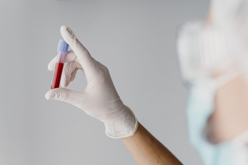 extracciones de sangre a domicilio, cañada de gomez