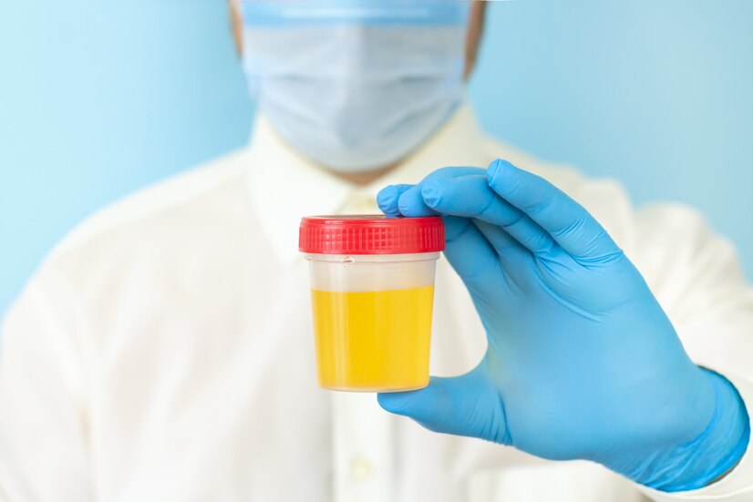 analisis de orina, laboratorio bioquimico cañada de gomez